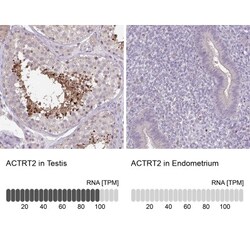ACTRT2 Antibody, Novus Biologicals:Antibodies:Primary Antibodies